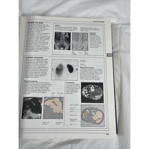 The American Medical Association Home Medical Encyclopedia by Charles B. Clayman - Picture 10 of 10